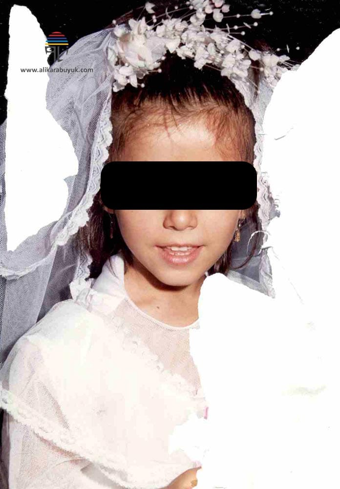 Hasar Görmüş Fotoğraf Tamiri 2 Yıpranmış Fotoğraf Tamiri Öncesi