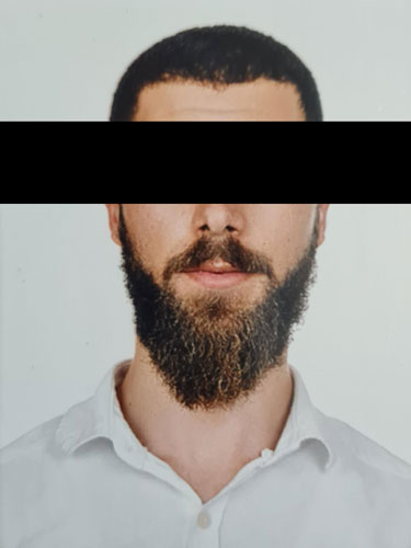 Sakal sildirme işlemi öncesinde yoğun ve sert sakal yapısına sahip erkek yüzü