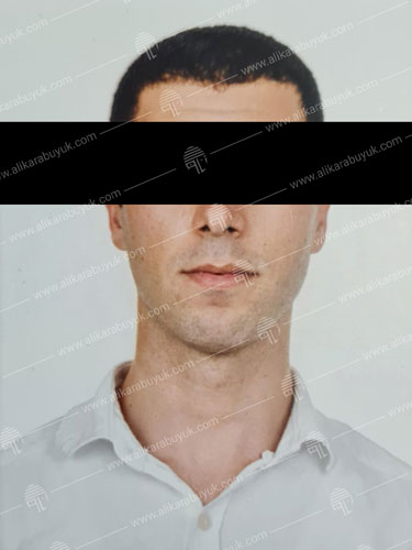 Sakal sildirme işlemi sonrası kıl yoğunluğu azalmış pürüzsüz erkek yüzü