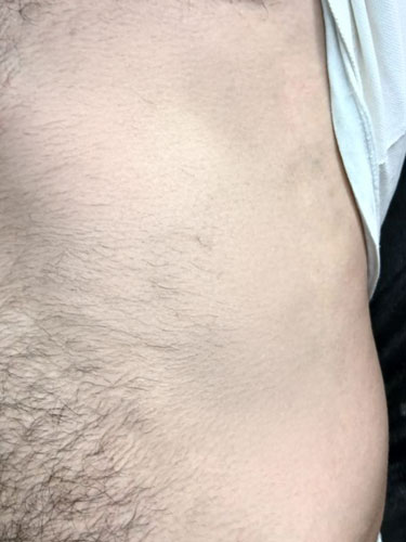 Erkek kişinin karın bölgesinin, dövme uygulanmadan önceki fotoğrafı